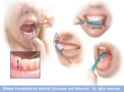 Good Oral Hygiene 1