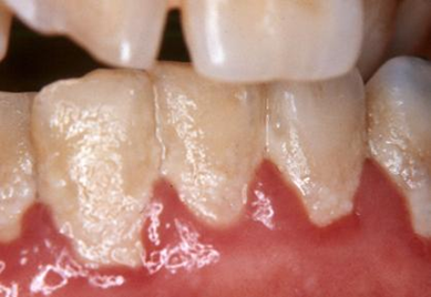 Good Oral Hygiene 2
