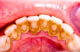 Good Oral Hygiene 3