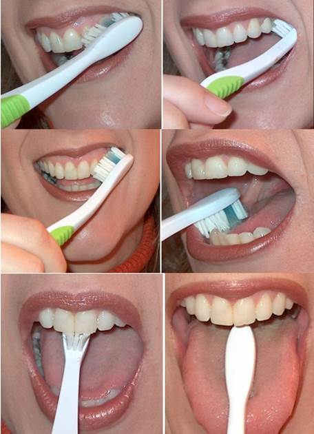 Good Oral Hygiene 6