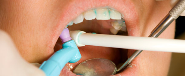 Good Oral Hygiene 8