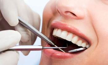 What Are Cavities 10