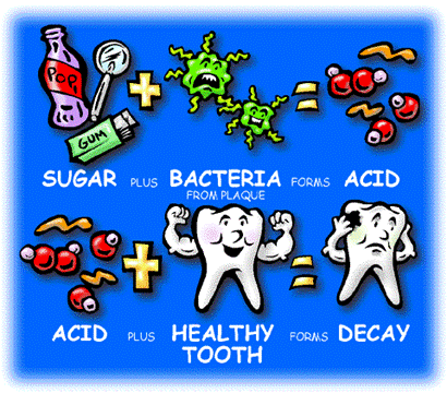 What Are Cavities 4