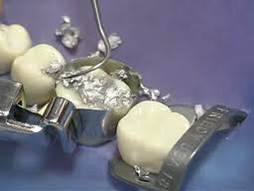 What are Fillings 3