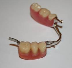 What are Partial Dentures 1