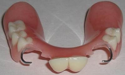 What are Partial Dentures 3