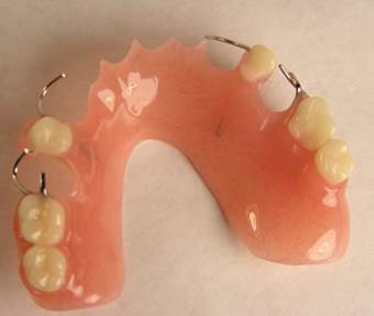 What are Partial Dentures 6