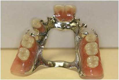 What are Partial Dentures 7