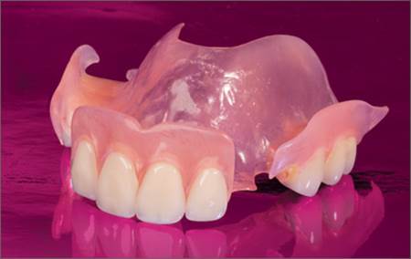 What are Partial Dentures 8