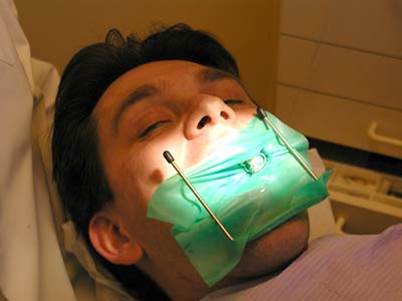 What are Root Canals 10