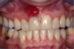 What are Root Canals 7