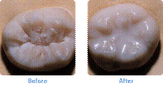 What are Sealants 1