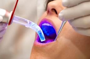 What are Sealants 6